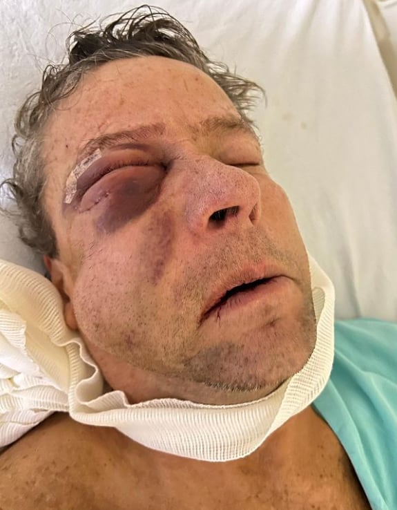 Alfredo Adame saliendo de operación