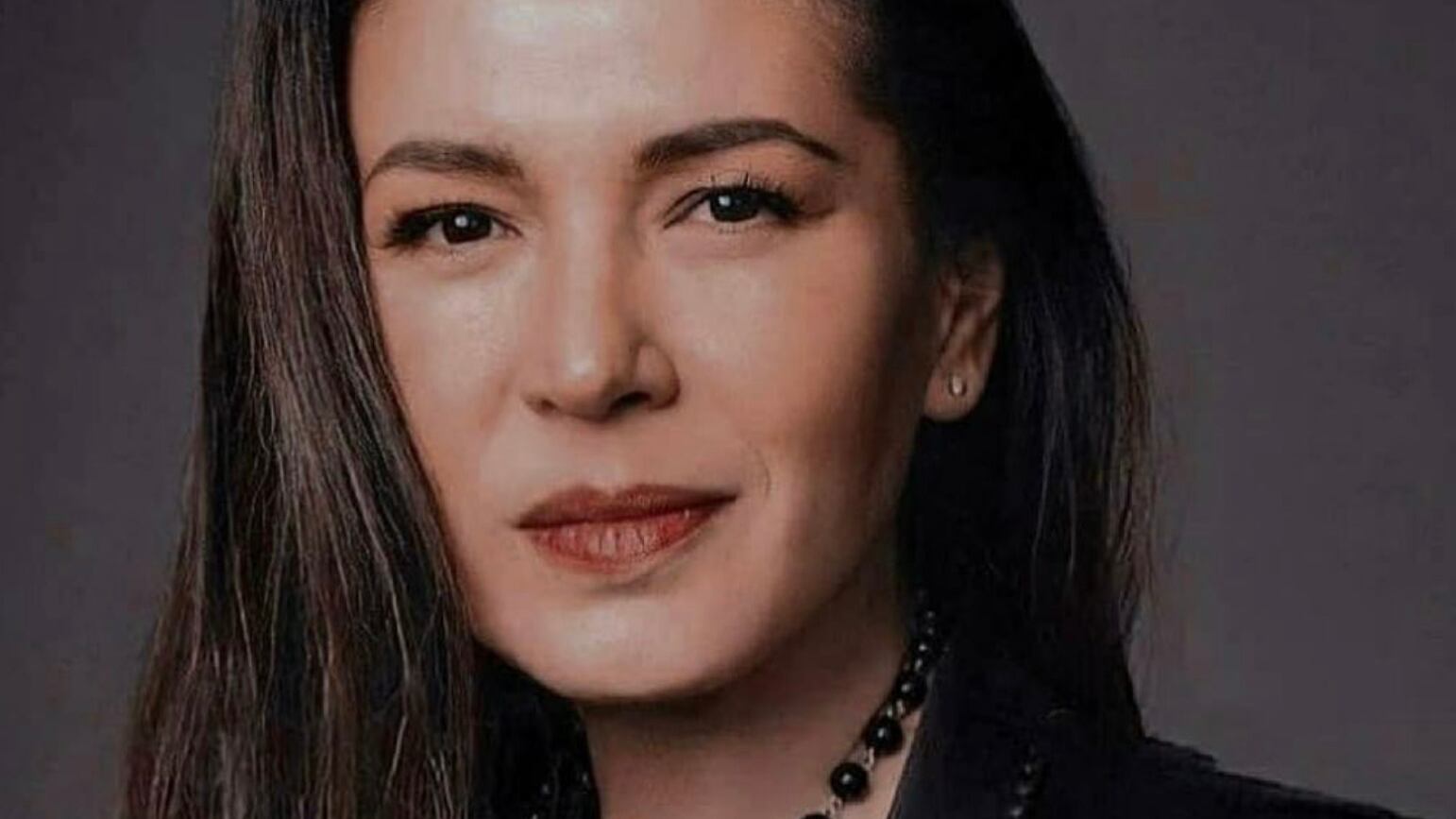 Yolanda Andrade comparte cambios físicos por vivir con esclerosis