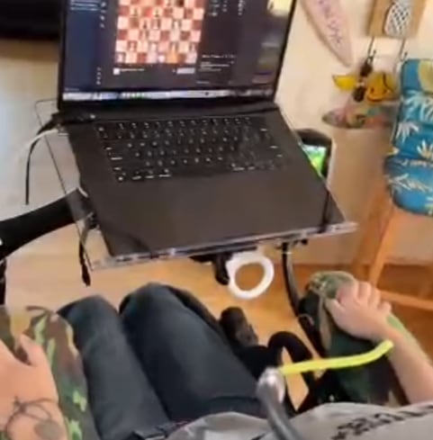 Primer paciente con Neuralink muestra lo que puede hacer con la mente