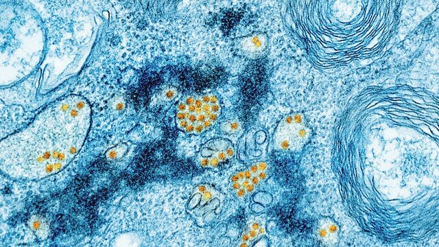 Fiebre amarilla: qué es, síntomas y cómo se contagia