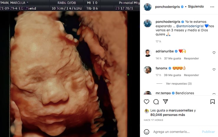 Cuarto hijo de Poncho de Nigris