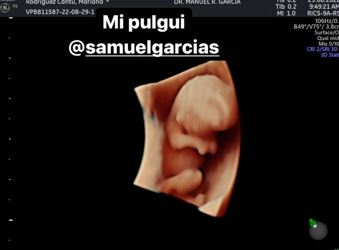 Mariana Rodríguez y Samuel García anuncian un muy deseado embarazo