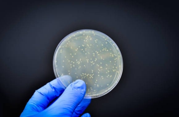 Imagen representativa de la listeria