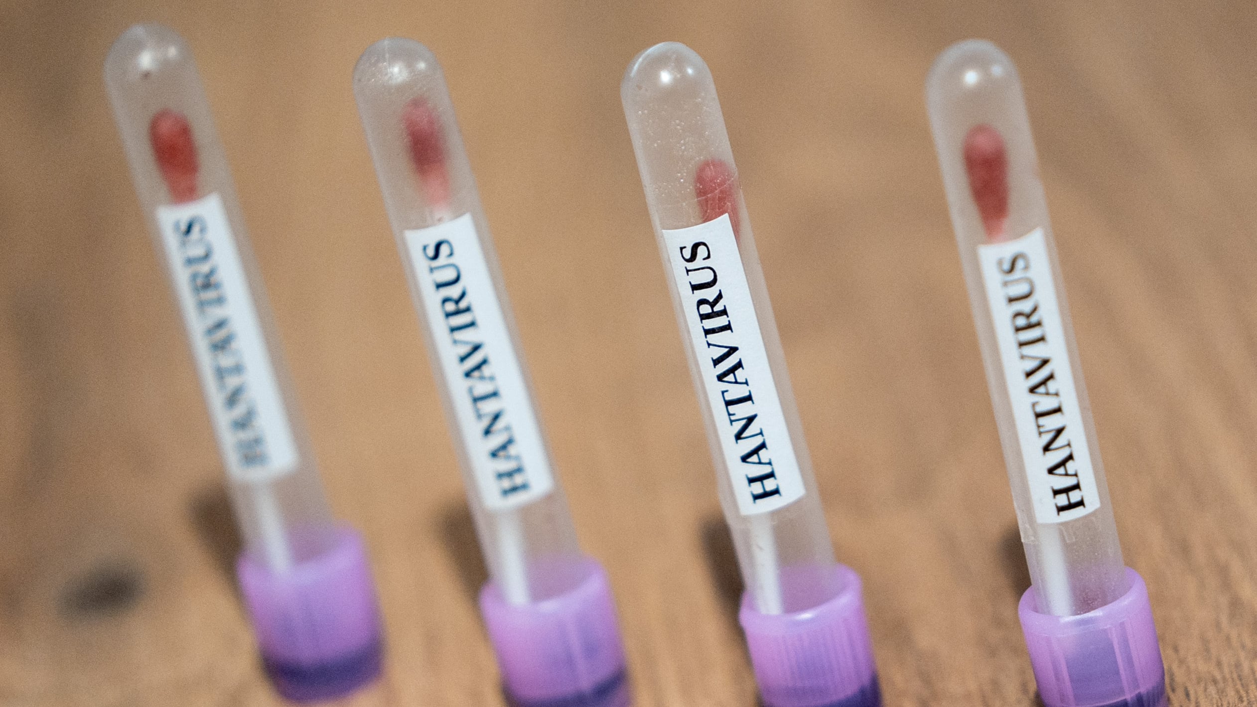 Hantavirus en Europa: confirman un caso en Reino Unido e investigan otro en España
