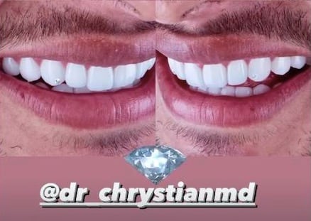 Dientes Alexis Vega