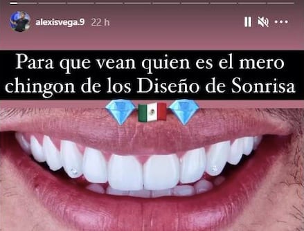 Dientes Alexis Vega
