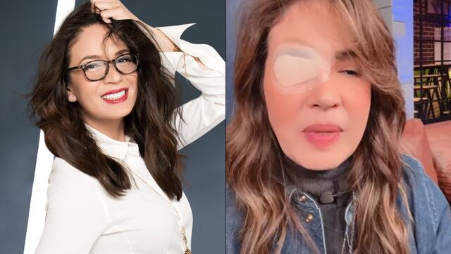 Yolanda Andrade reaparece con parche en el ojo