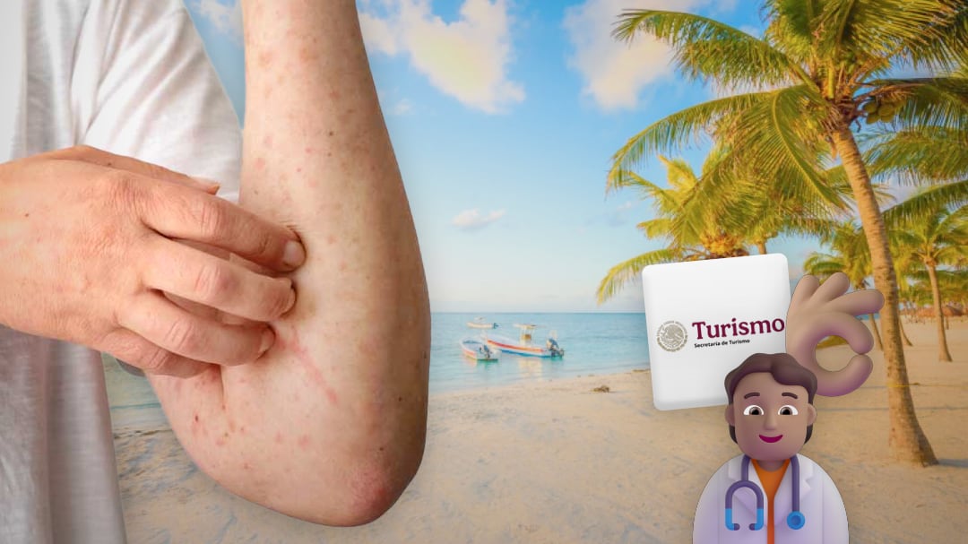 Descarta Sectur restricciones al turismo en México por brote de sarampión