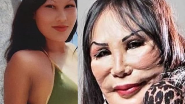 Lyn May antes y después de las operaciones