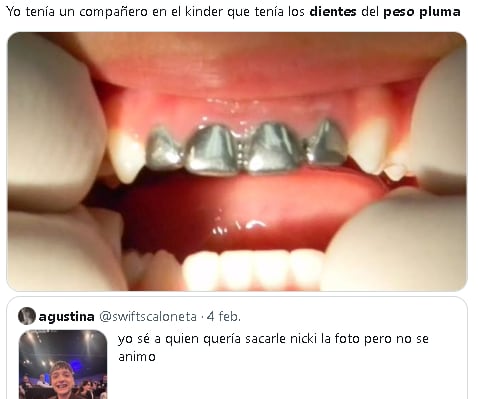 Se burlan de Peso Pluma por sus dientes de oro.