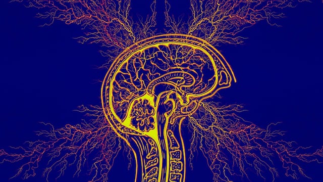 Representación del Síndrome de Tourette, trastorno neurológico