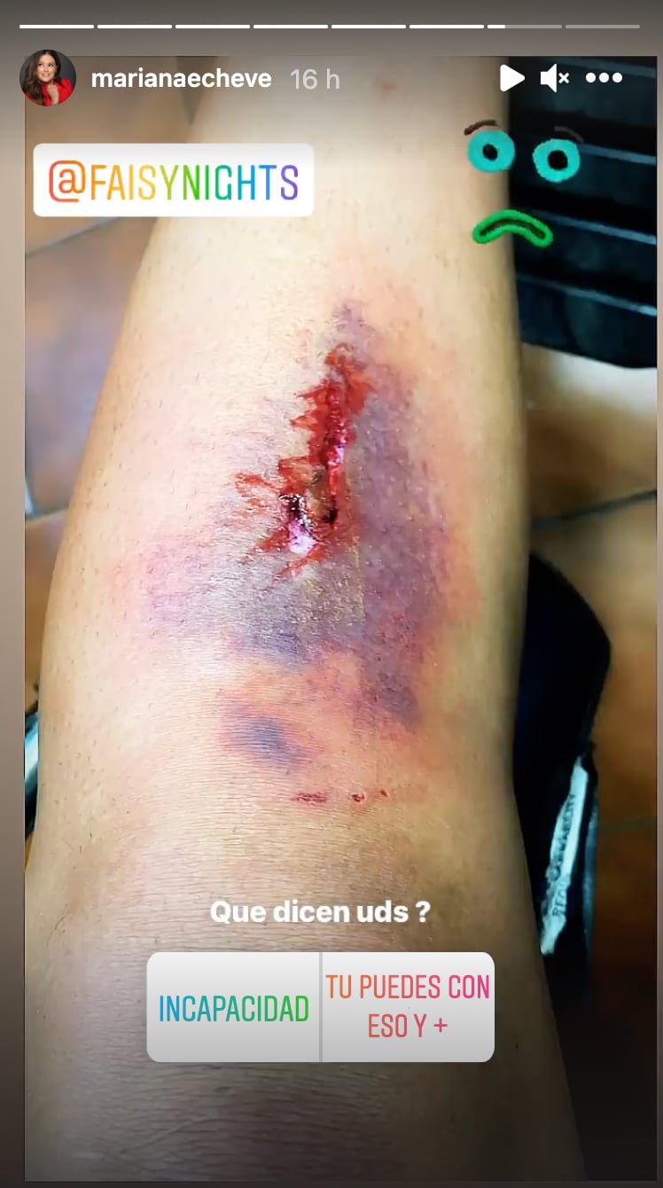 Mariana Echeverría sufre caída