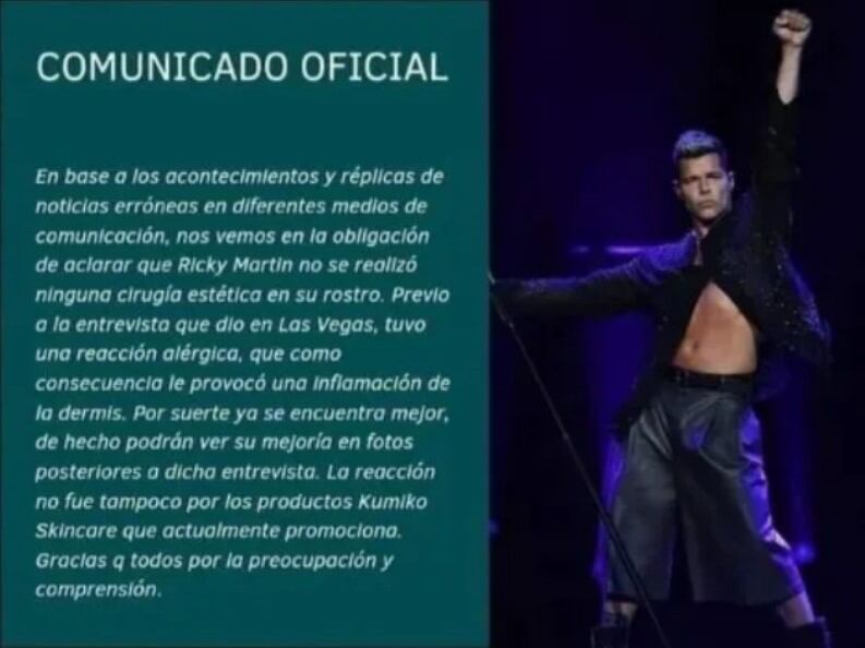 Comunicado de Ricky Martin