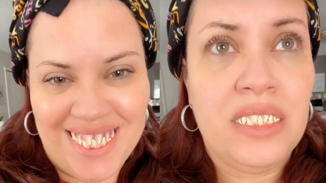 Se le pegan unos dientes de Halloween y se hace viral en TikTok