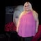 ¿Quién es Sheyla Tadeo? La cantante perdió 58 kilos y donó el exceso de piel para ayudar a niños quemados