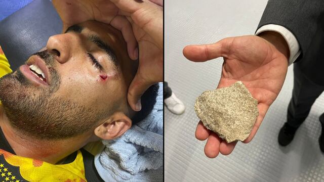 Ex Liga MX recibe piedrazo en el rostro desde las gradas