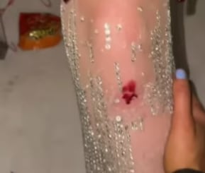 Lele Pons terminó con la rodilla lastimada durante su despedida de soltera