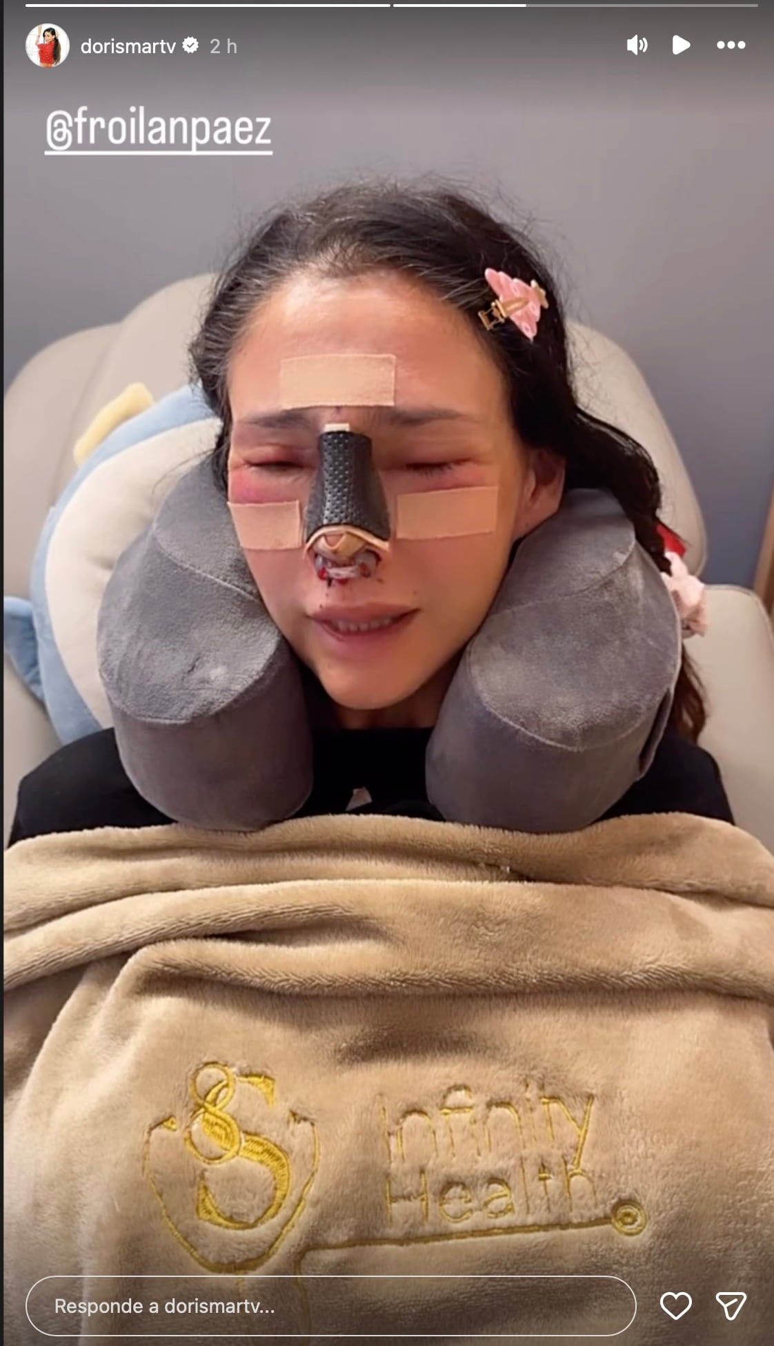 Así luce Dorismar tras una cirugía estética con complicaciones