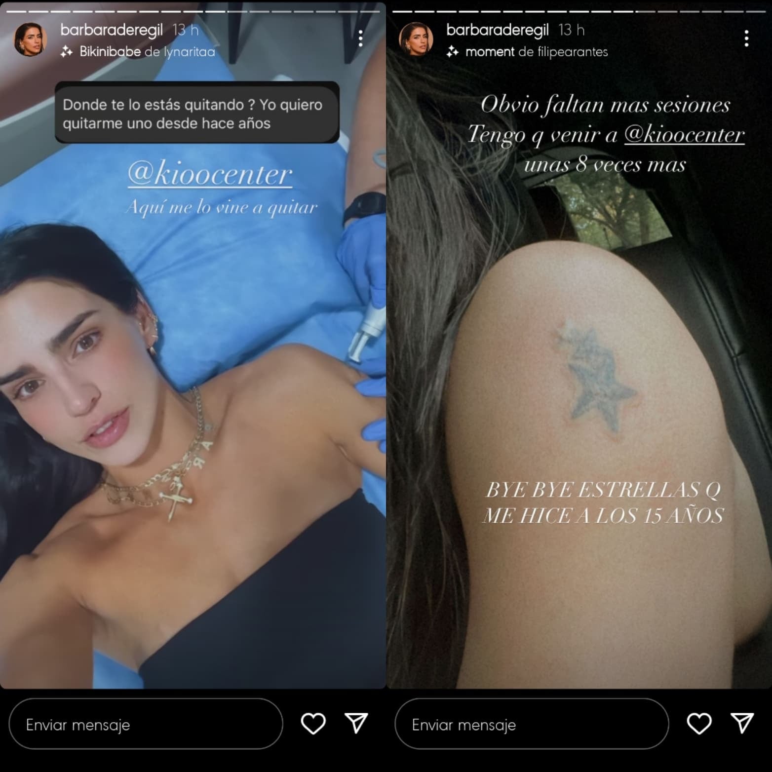 Bárbara de Regil se quita tatuaje del brazo.