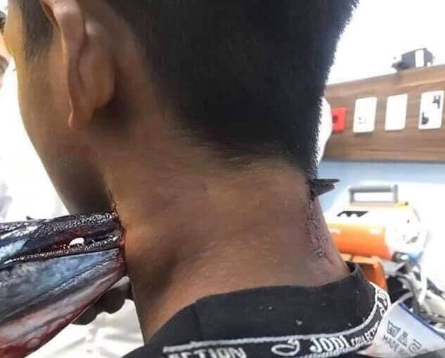 Pez espada atraviesa cuello de joven