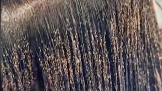 Cabeza llena de liendres