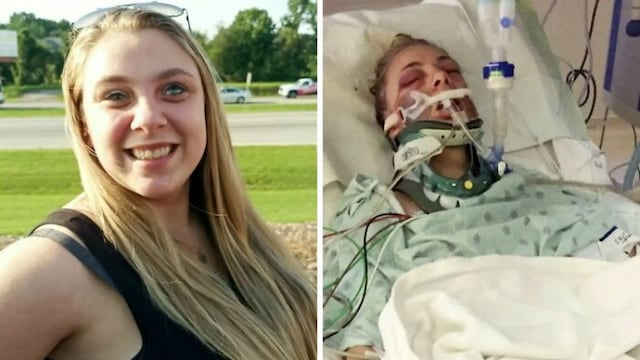 La psicosis por metanfetaminas le cambió la vida a esta joven para siempre