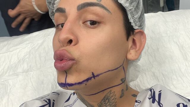 Kunno se realiza la lipopapada