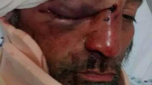 Jorge Martínez, reportero de Michoacán fue agredido en Tacámbaro