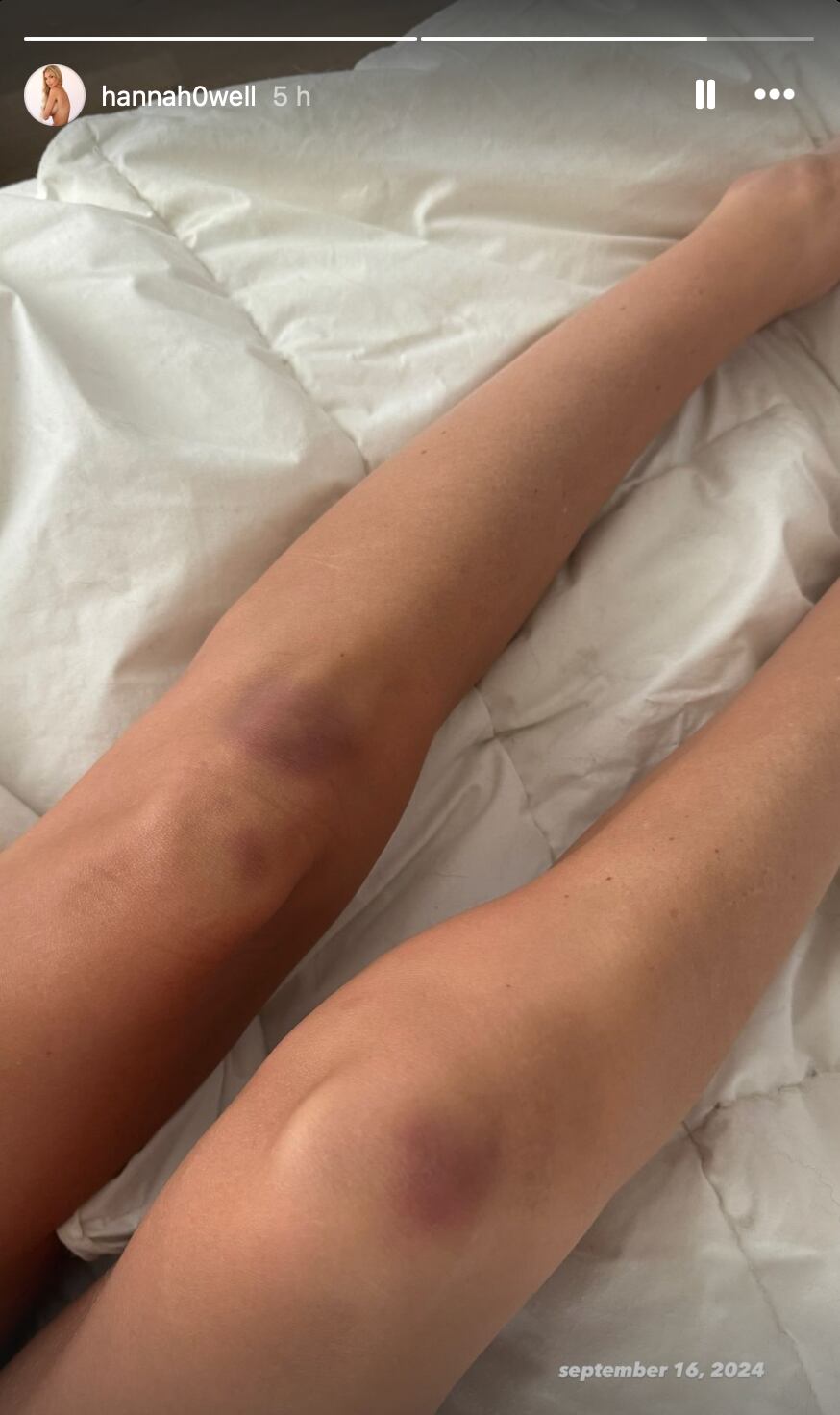 ¿Hanna Howell sufrió maltrato tras su relación con Peso Pluma?