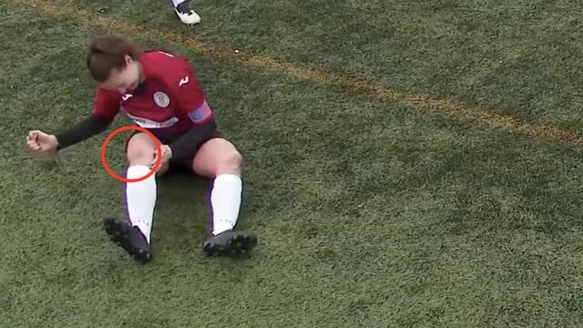 La jugadora se reacomodó la rodilla a golpes