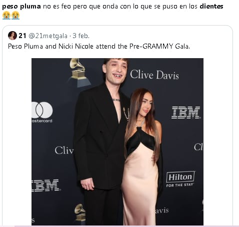 Critican a Peso Pluma por sus dientes de oro.