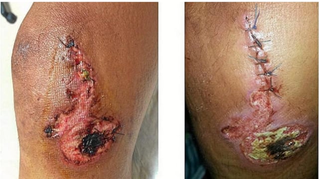 Contador se hizo con la victoria en la Vuelta de España con una de sus rodillas en muy malas condiciones ¡Impresionante lo del corredor español!