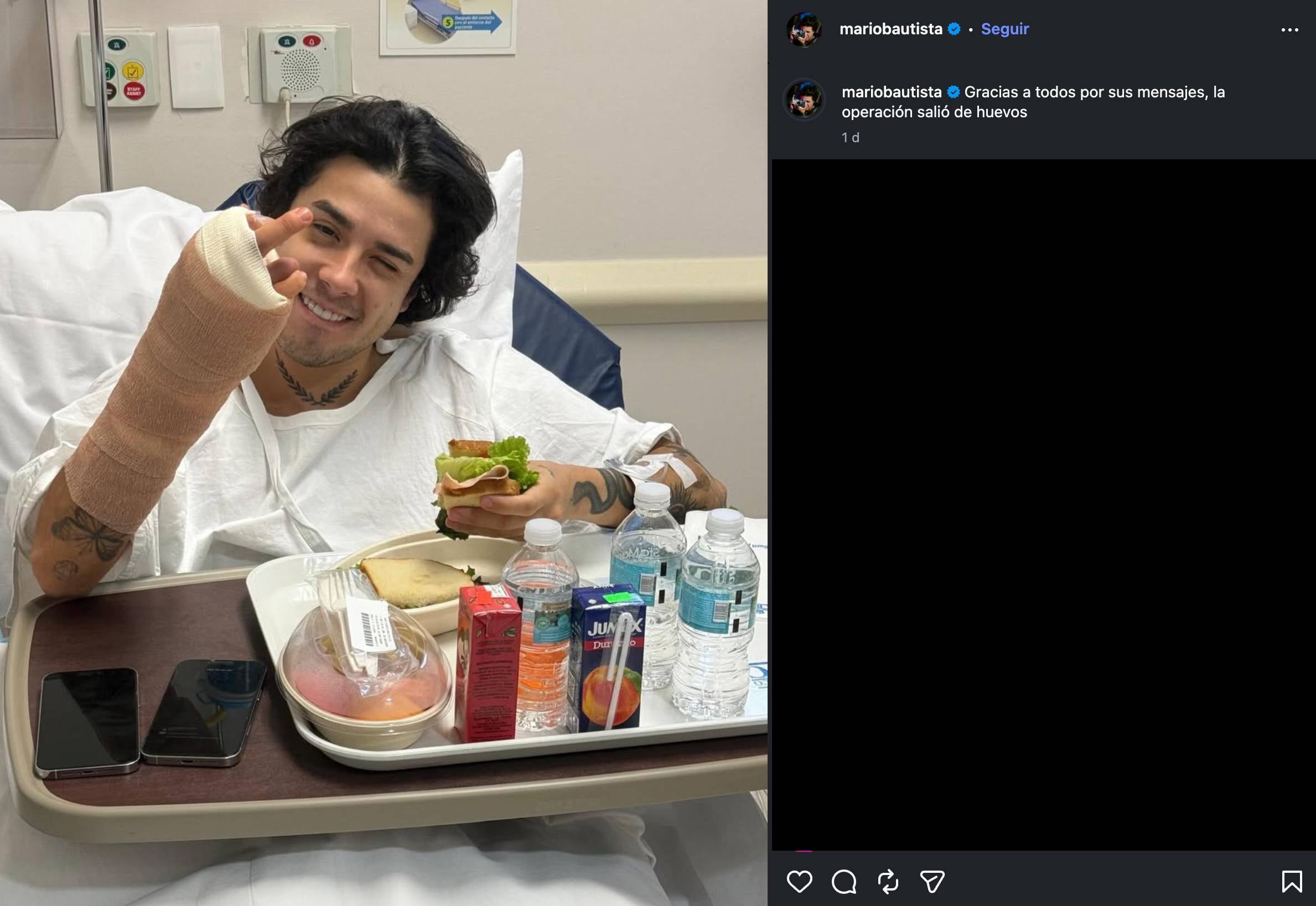 Mario Bautista se somete a una cirugía en la mano