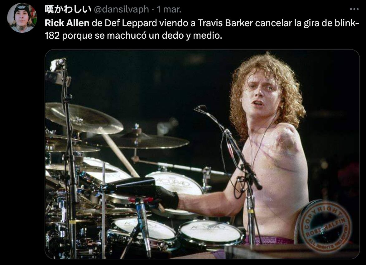 Comparación Travis Barker y Rick Allen