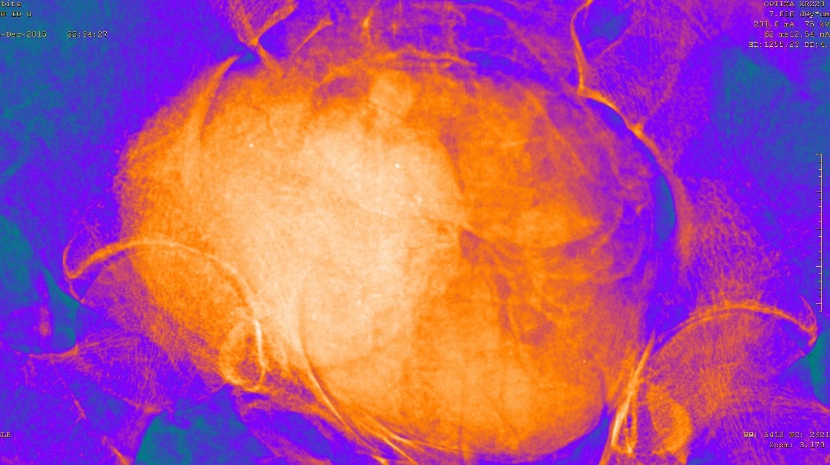 Vientre de momia embarazada