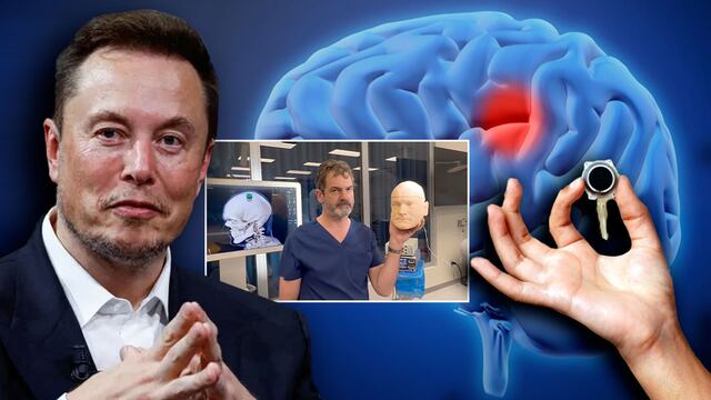 Neuralink de Elon Musk hizo historia instalando el primer chip en un cerebro humano