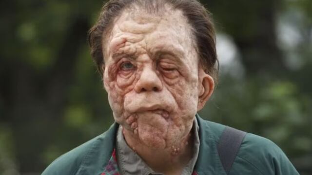 A Different Man con Sebastian Stan