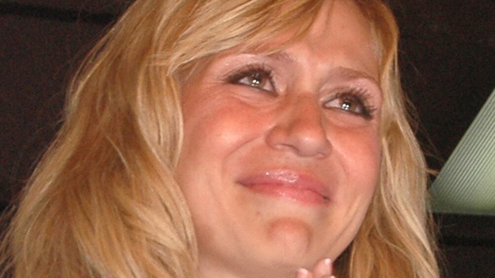 Noelia sufre vitíligo desde hace 15 años