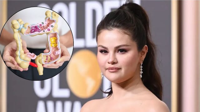 ¿Qué es el SIBO, la enfermedad que Selena Gomez confesó padecer? Te decimos los síntomas y si se cura