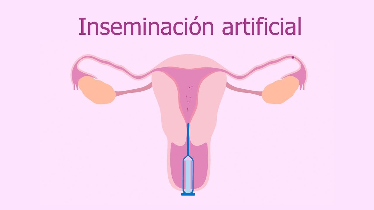 inseminación artificial
