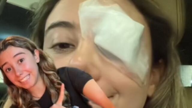 Remedio de TikTok le provocó una perrilla y acabó en el hospital en cirugía