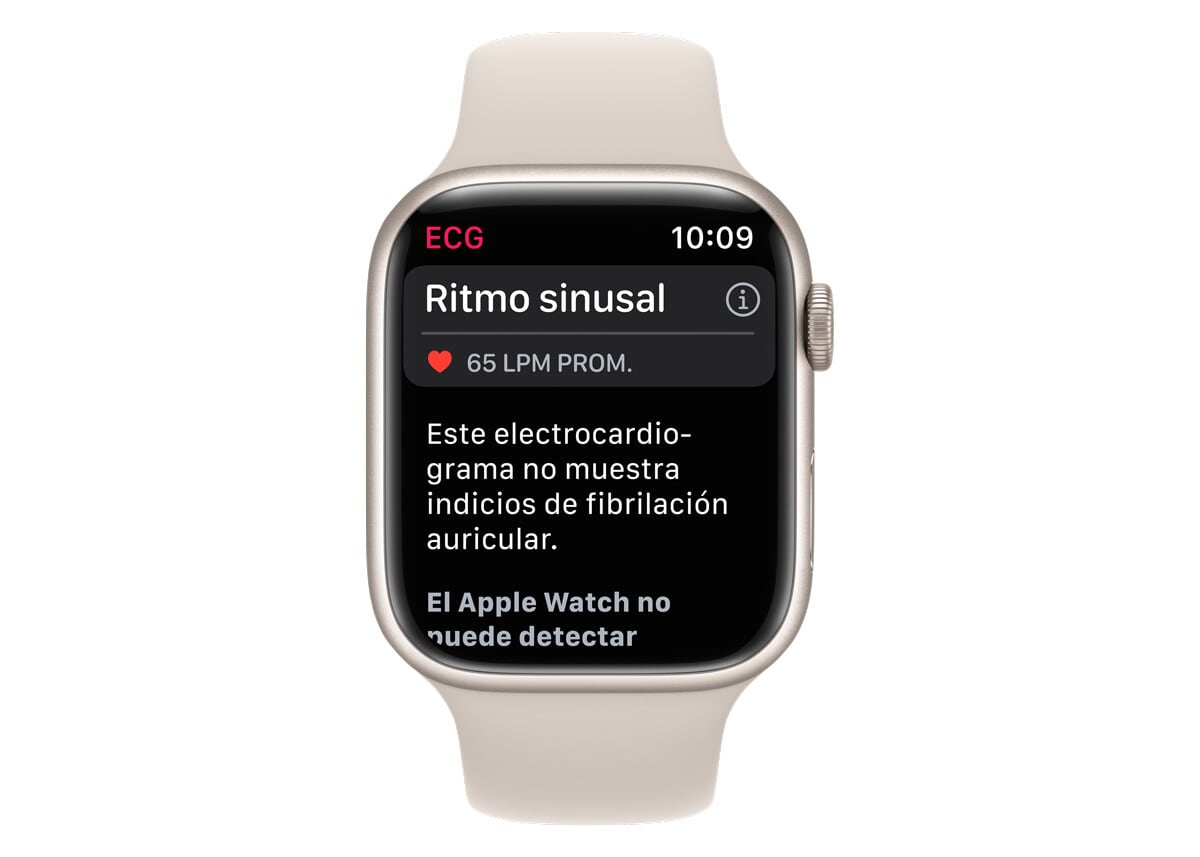 El electrocardiograma de Apple Watch ya está disponible en México
