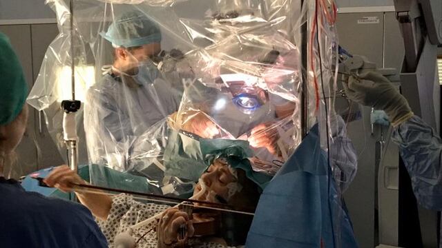 Una violinista tocó en medio de su cirugía cerebral