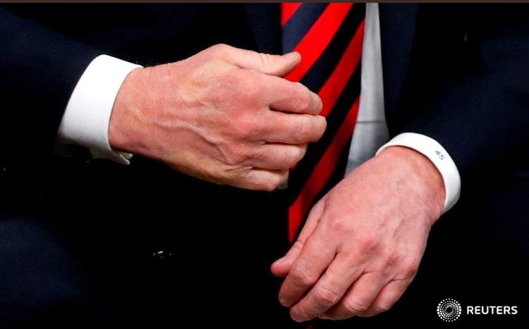 Mano de Donald Trump con marca del pulgar de Emmanuel Macron