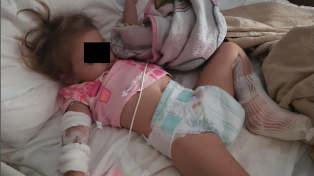 Bebé castigada con agua hirviendo