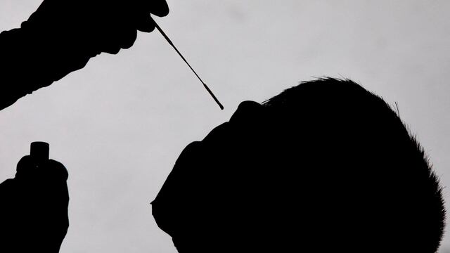 Prueba de diagnóstico Covid-19