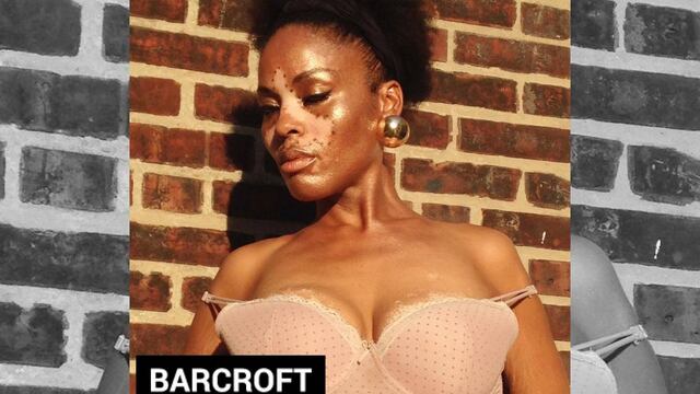  Archie - es afroamericana, pero tiene manchas blancas que cubren su nariz, labios, senos, rodillas y espalda que según ella, provoca envidia a las mujeres.