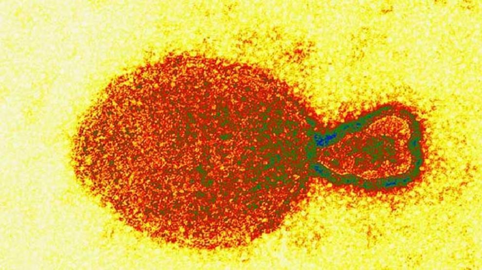 Henipavirus/internet