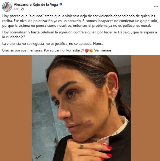 Alessandra Rojo de la Vega acusa agresión en Zona Rosa, CDMX.