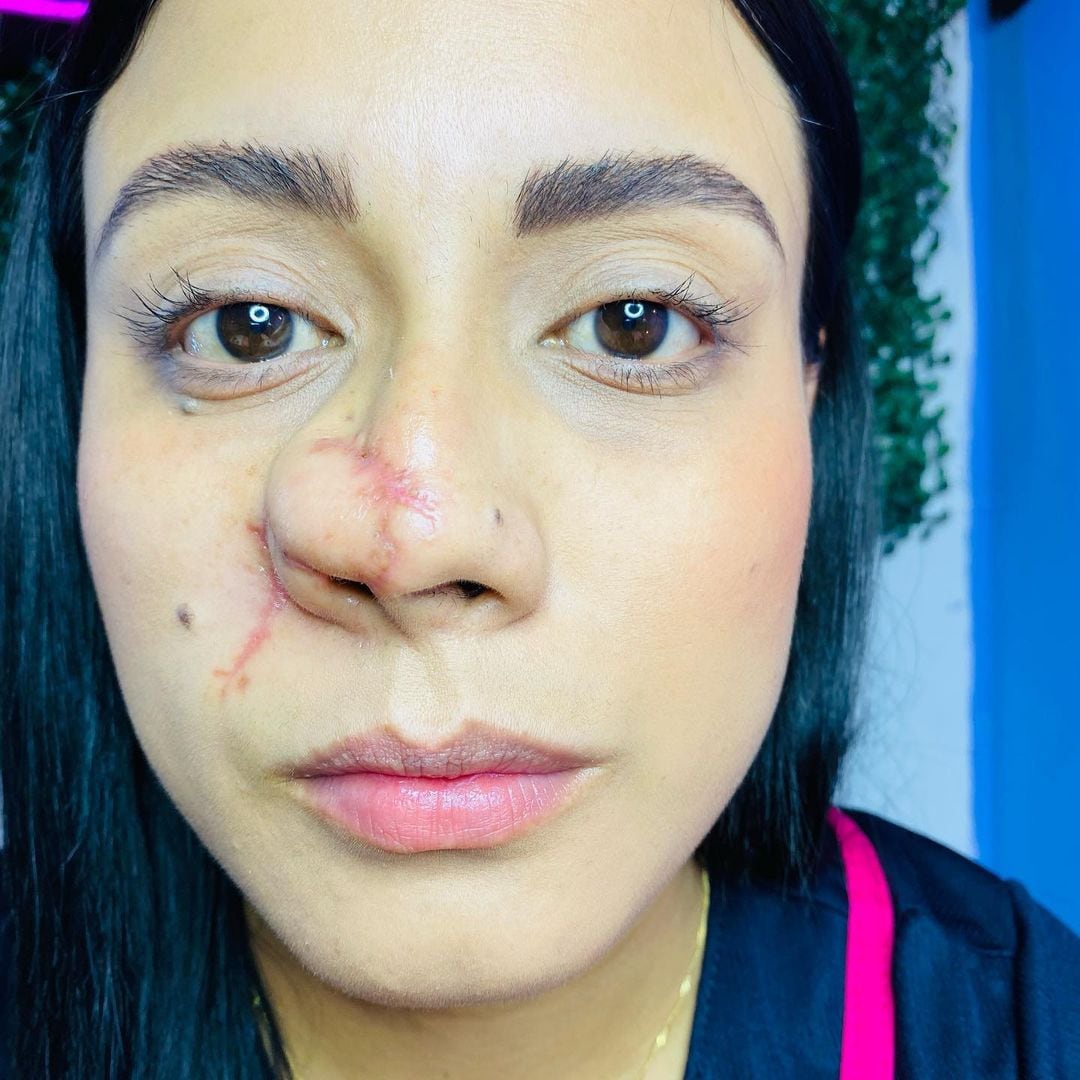 Jazmín fue atacada por Roberto de Anda en Tlalixcoyan, Veracruz